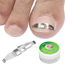 Load image into Gallery viewer, 4pcs/set Stainless Ingrown Toe Nail Fixer Pedicure Recover Embed Toenail Correction Lifter Tool Kit
